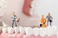 【健康解碼】洗牙會損害牙齒嗎？